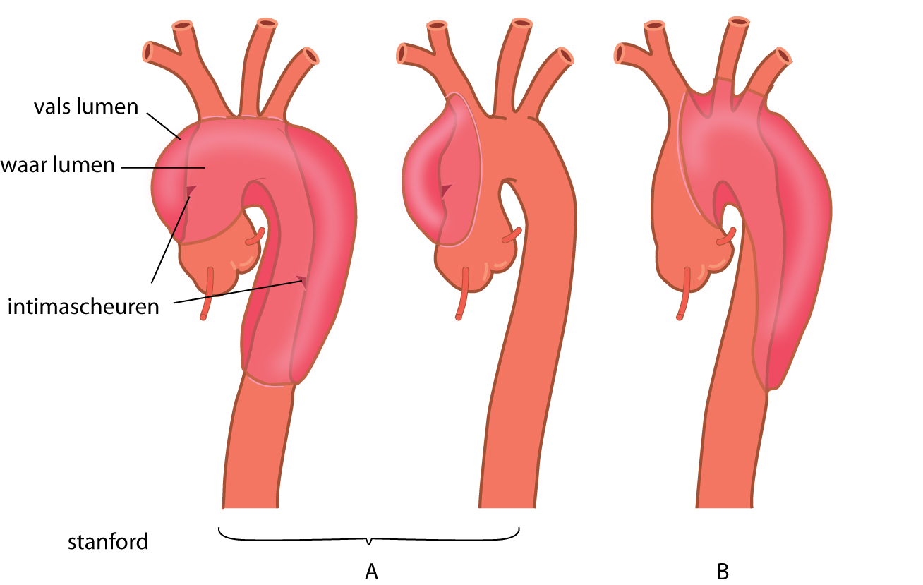 Aorta oh слив фото